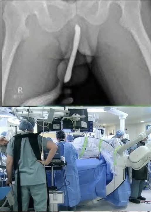 Girl had to be hospitalized for wanting to use a pe…