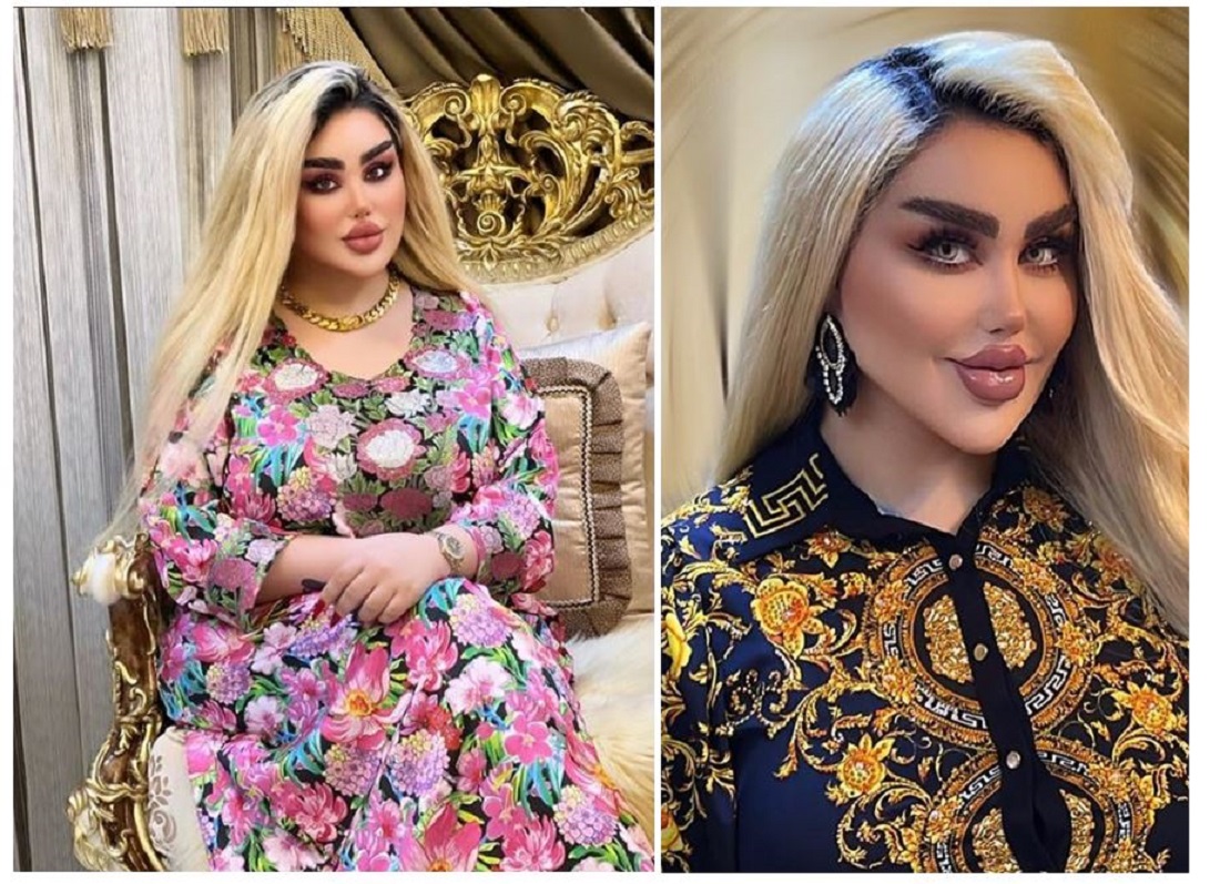 43 Surgeries to Look Like a Doll Spark Controversy