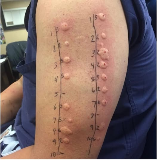 These are the consequences of sleeping with the…