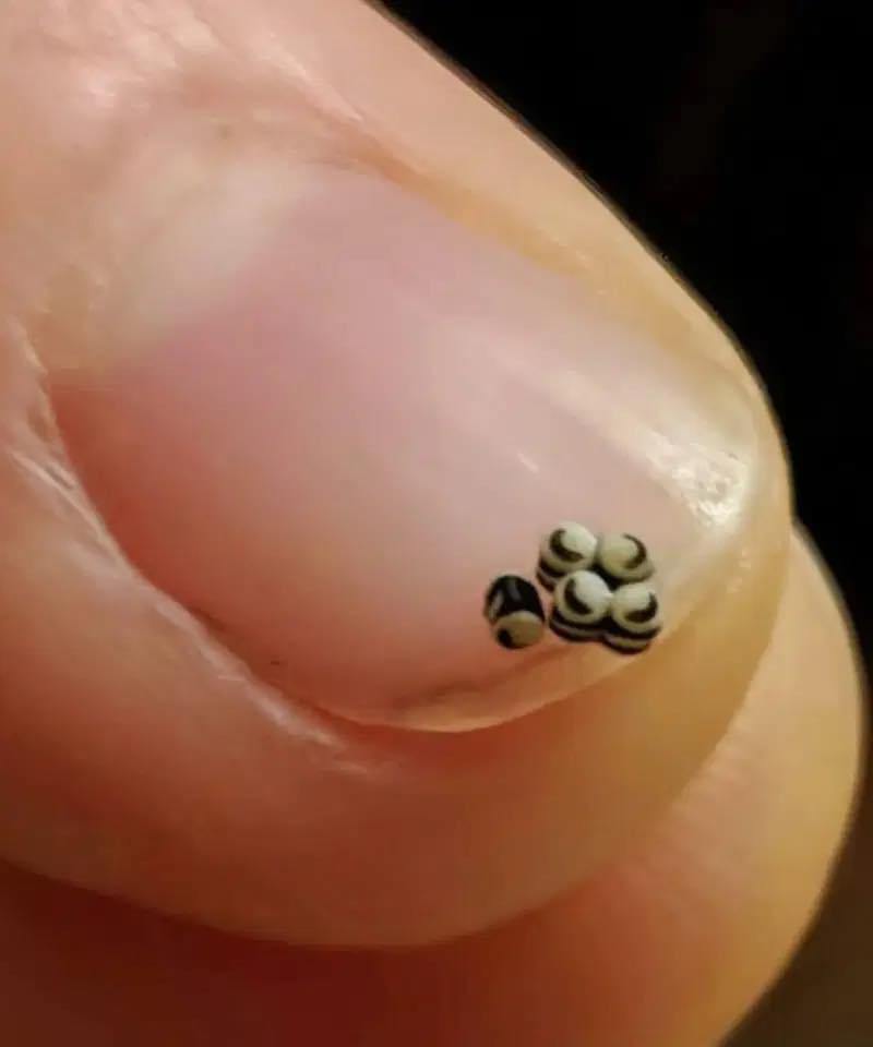 We ordered a salad, discovered black flecks in it, and went straight to the hospital