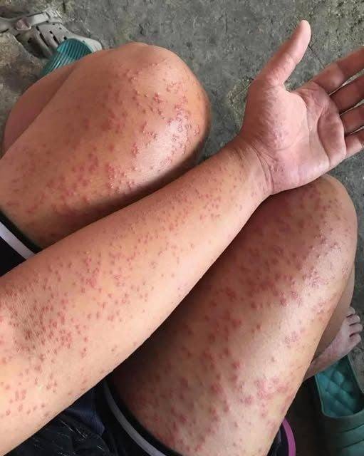 I spent a couple of nights at my friend’s previous apartment and saw these unusual bumps