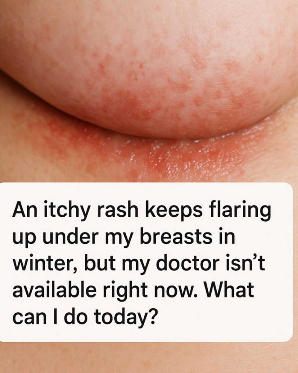 Itchy Rashes Under Your Breasts? How to Treat Them This Winter
