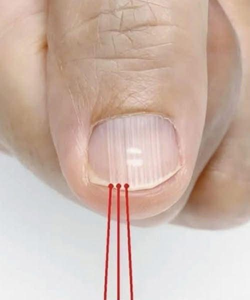 If you have these lines on your nails after 40, it is a clear sign that..
