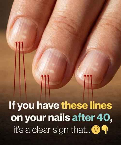 Foods That Help Strengthen Brittle Nails After 40