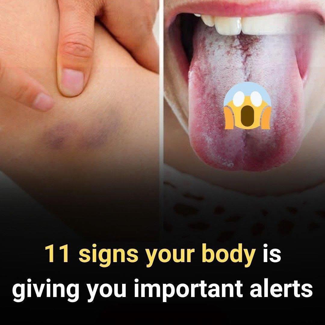 11 warning signs your body gives about your health