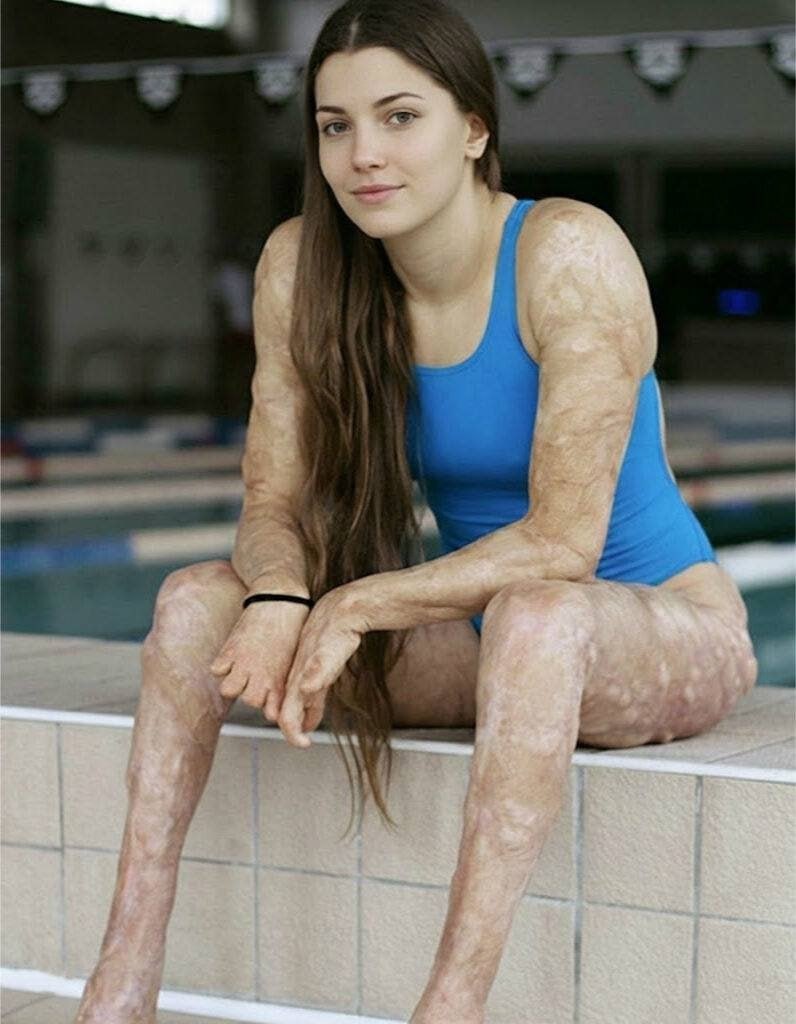 Well These are the consequences