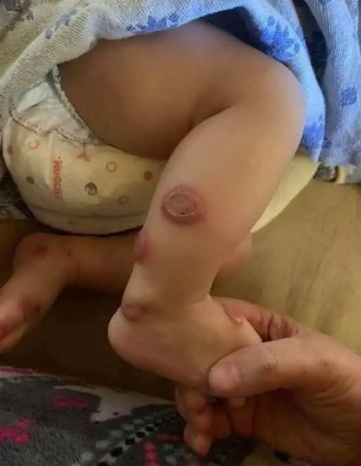 ALERT: These are the