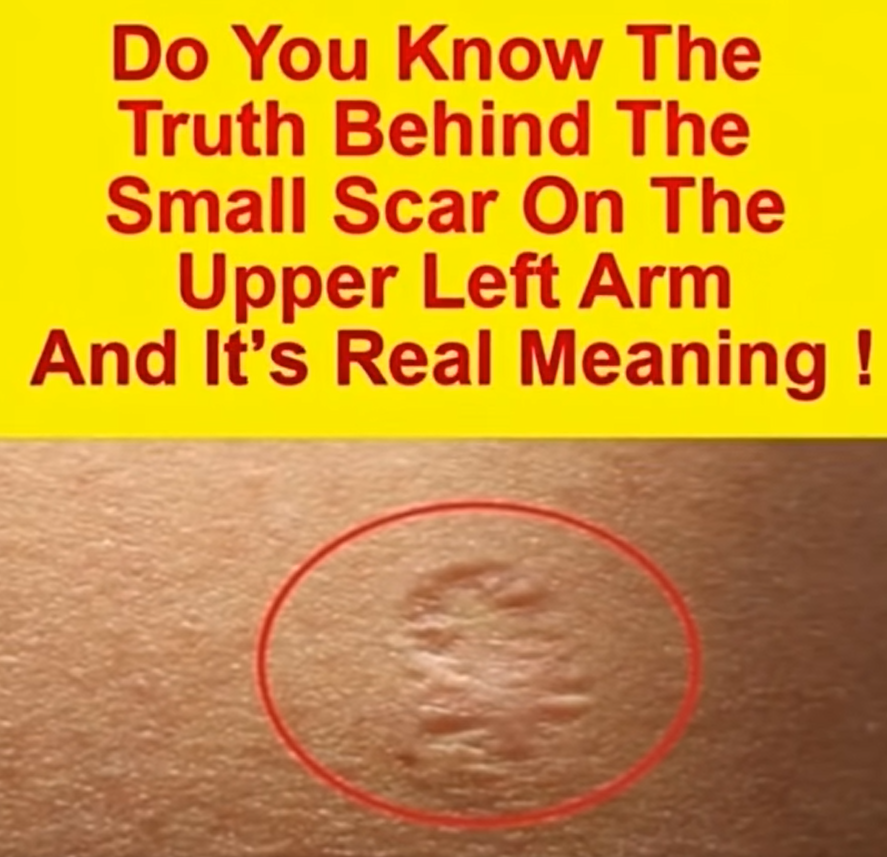 You’ve Seen This Scar Before — But Do You Know Why It’s There?