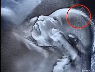 Doctors couldn’t believe what they saw during the ultrasound
