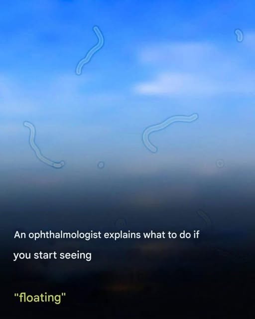 Eye floaters: what they are and what to do if you notice them, according to an eye doctor