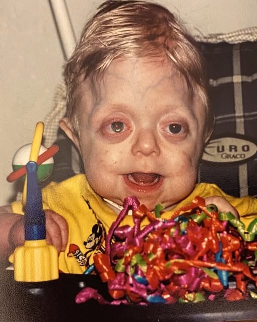 Teen Defies the Odds: Braden Graduates High School Despite Early Prognosis