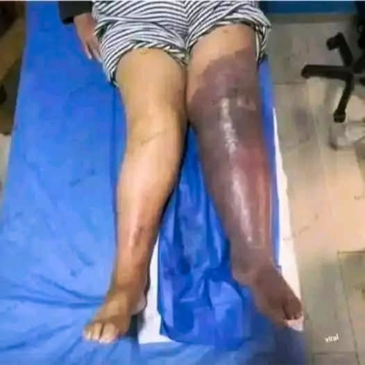 The Shocking Consequences of Sleeping With the…