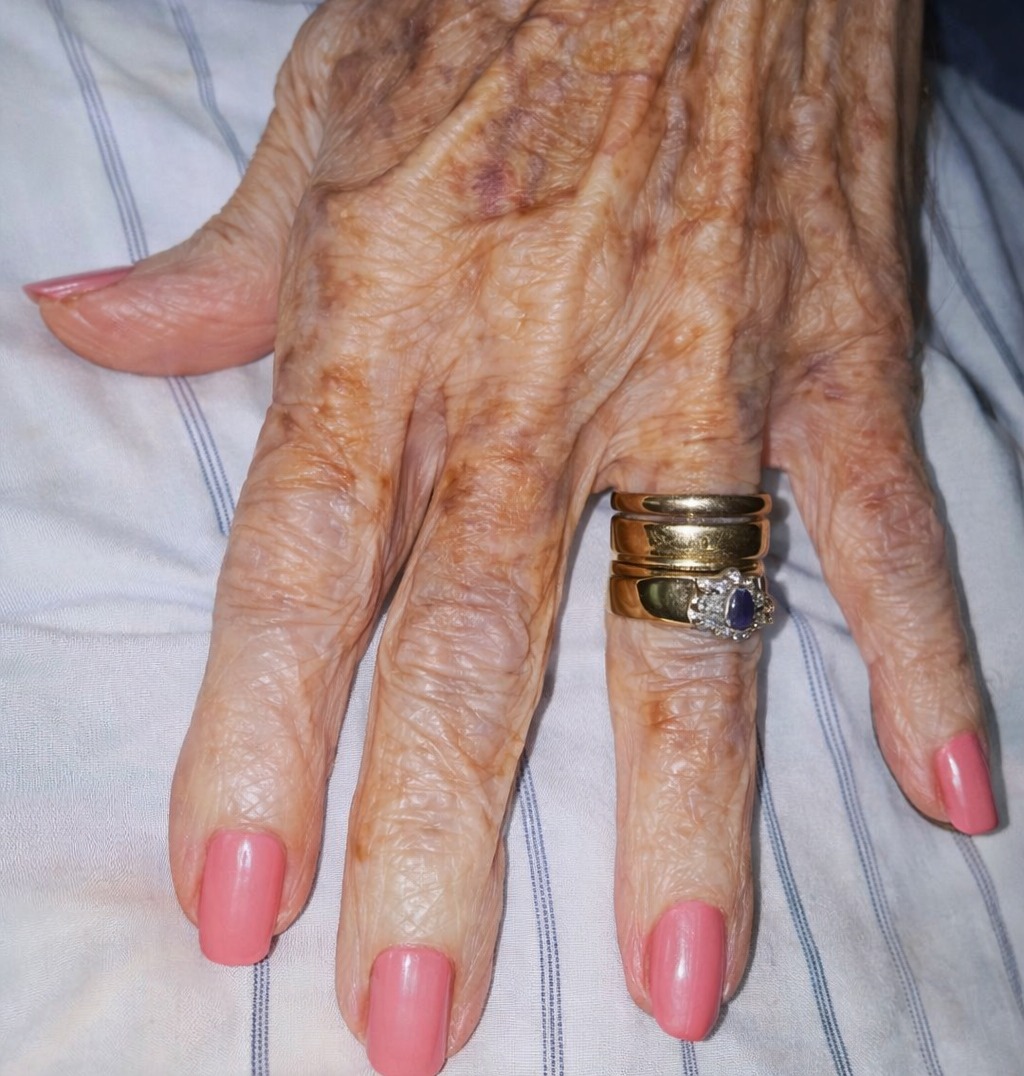 Nurse Sparks Online Reaction After Sharing Photo of Elderly Woman’s Hand