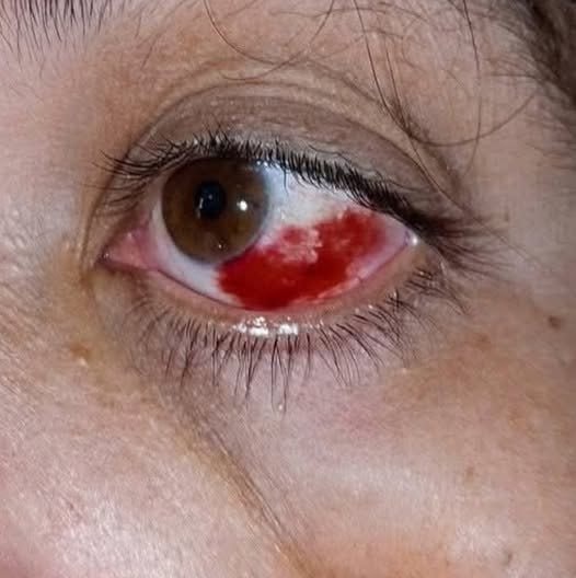 Be careful! These are the consequences of sleeping with the…