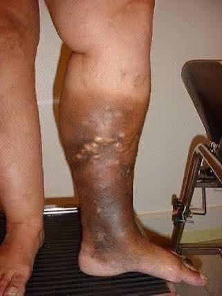 These are the first symptoms