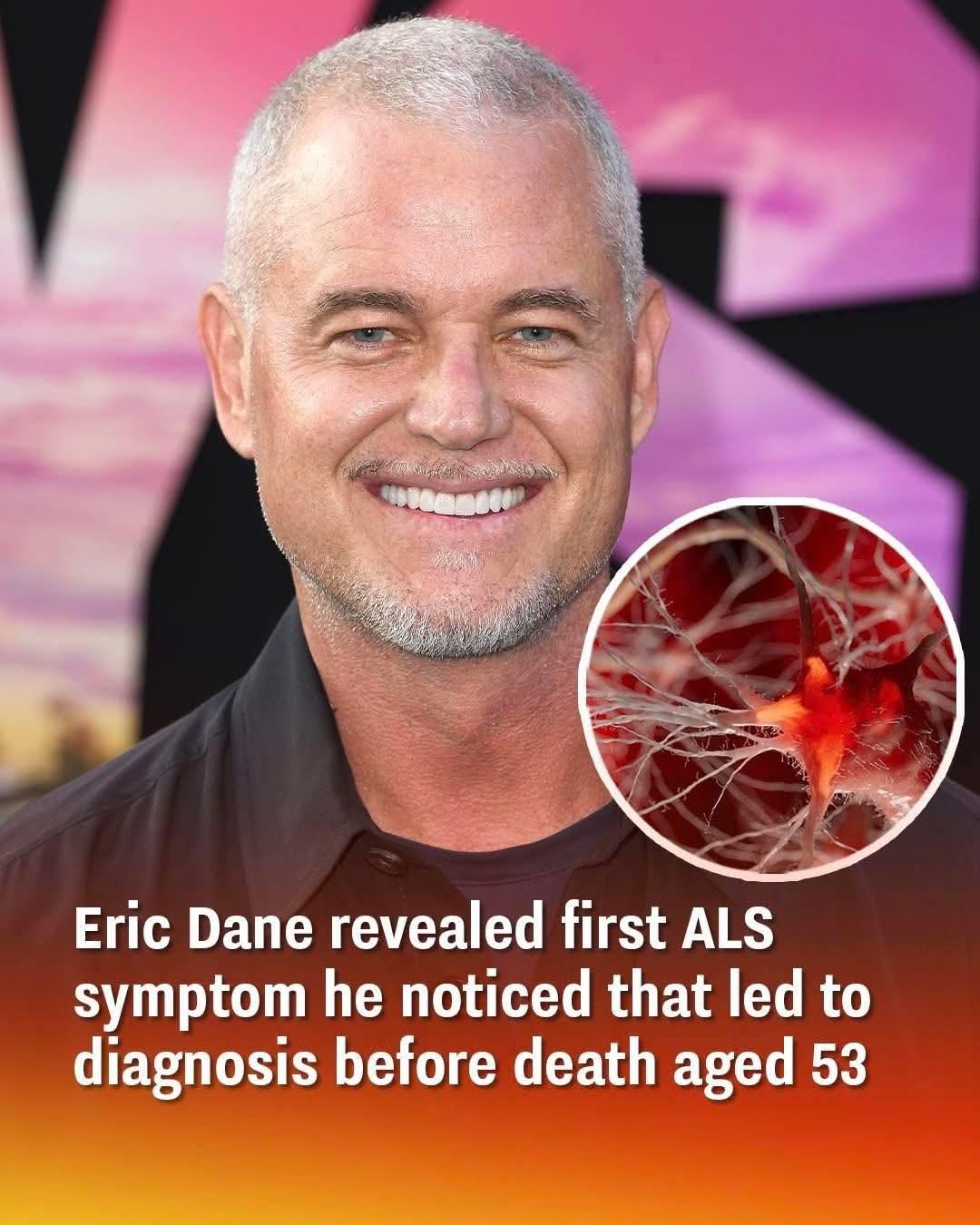Eric Dane revealed first ALS symptom he noticed