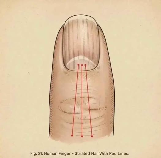 If you have these lines on your nails after 40, it is a clear sign that..