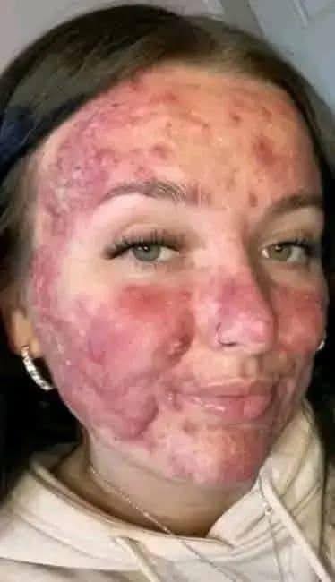 Her Body Was Itchy, He Thought It Was An Allergy