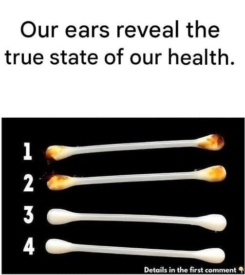 Our ears reveal our true state of health