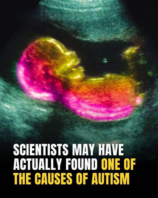 Study identifies possible connection to autism development