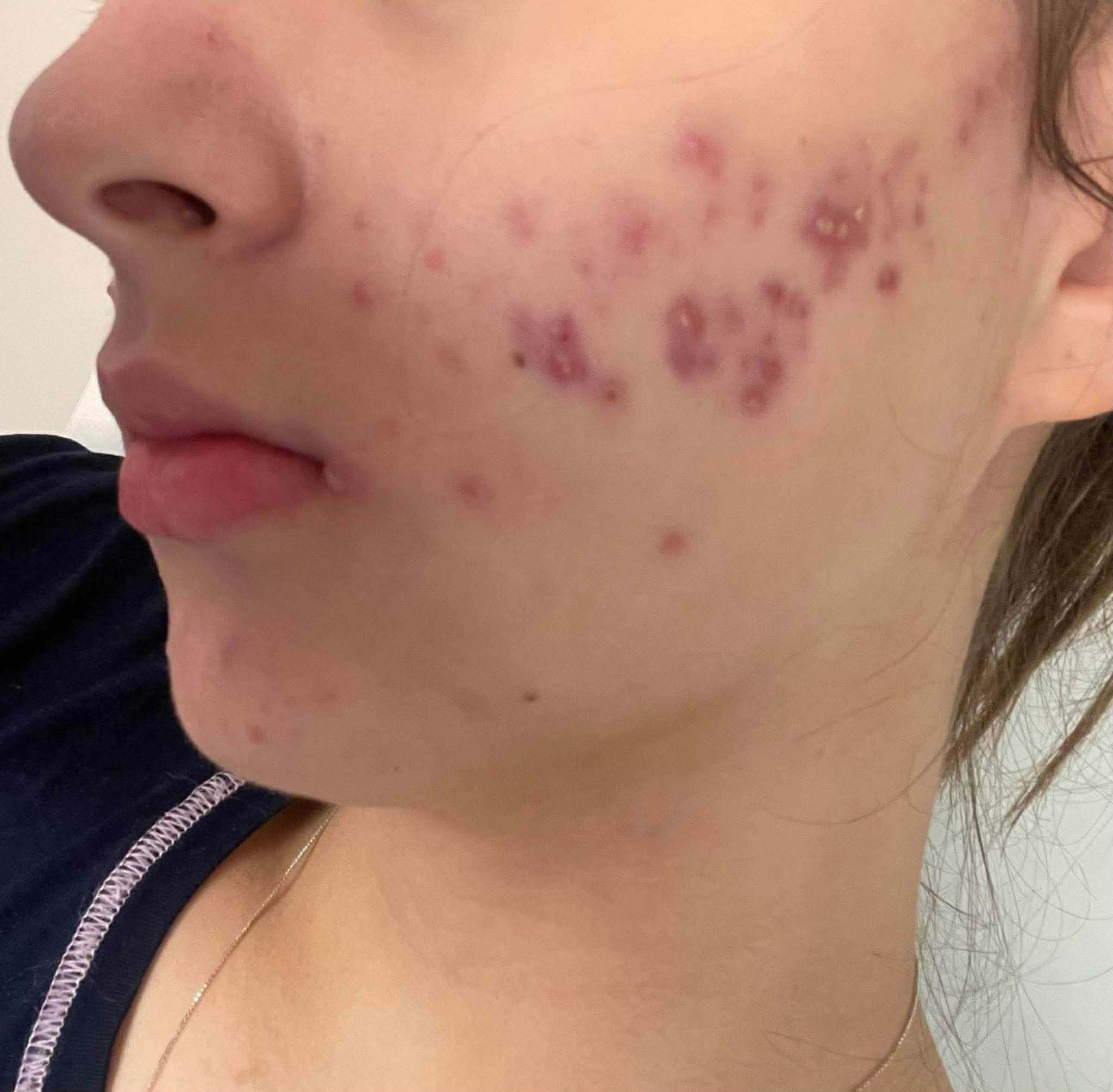 These are the consequences of sleeping with the…