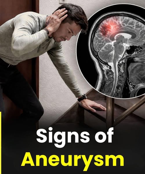 War:ning Signs of Aneurysm in Men: What You Should Never Ignore