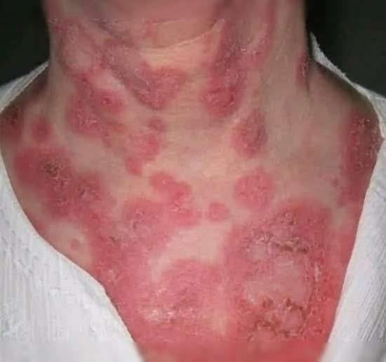 These are the consequences of sleeping with the