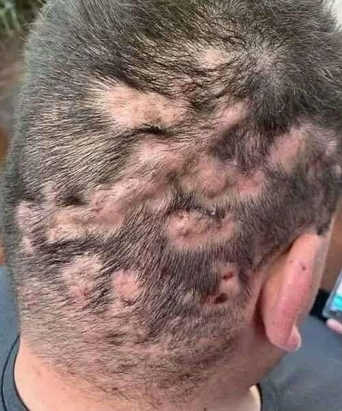 These are the first symptoms