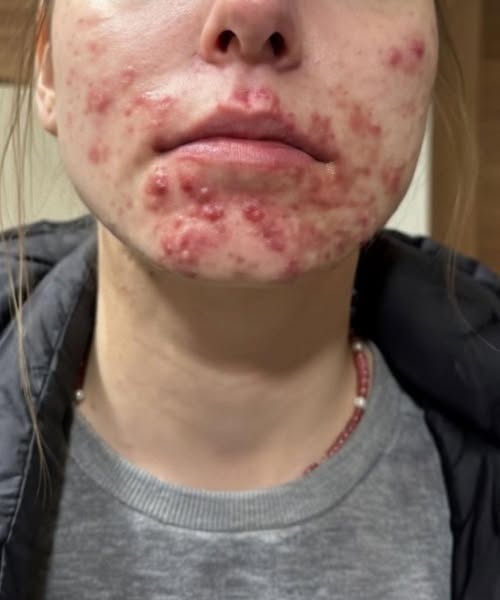 These are the consequences of sleeping with your c…