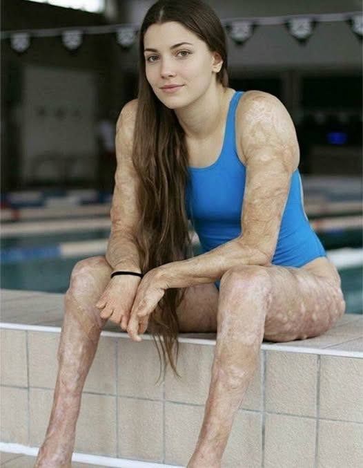 These are the consequences of sleeping with the…S