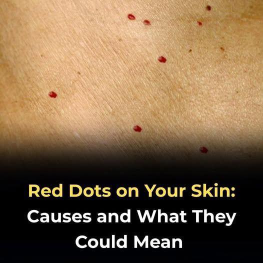 Red dots on your skin: Causes and what they could mean