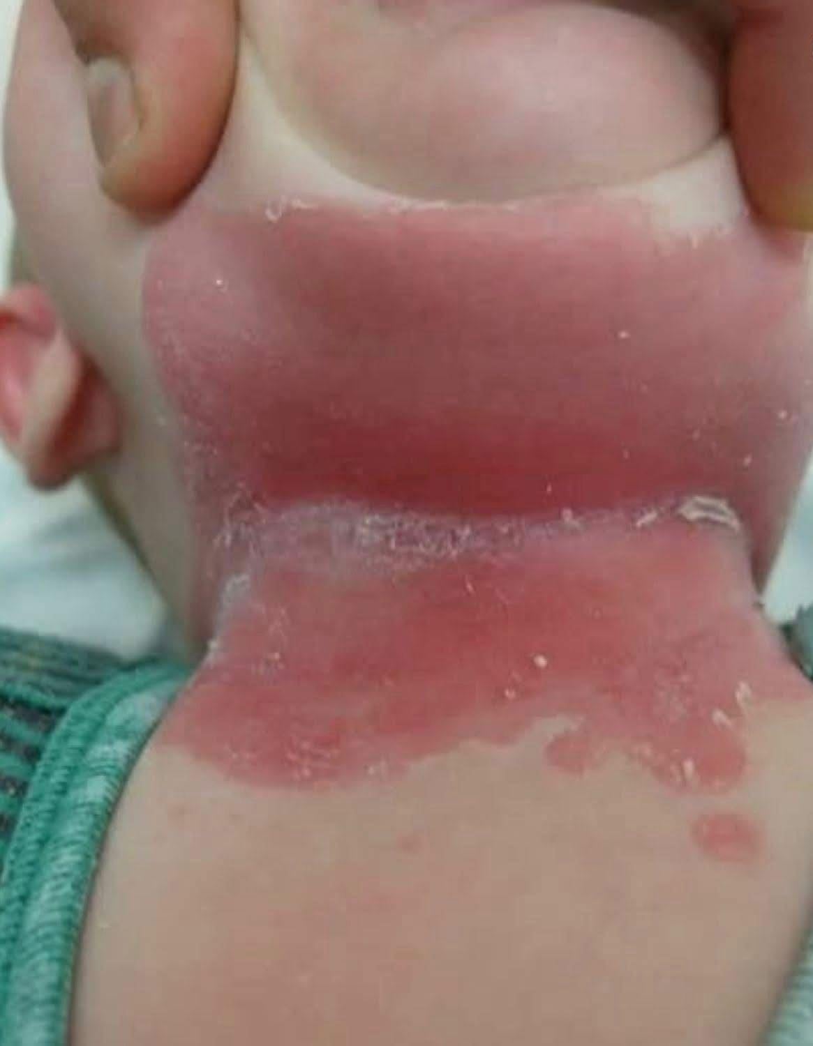 These are the consequences