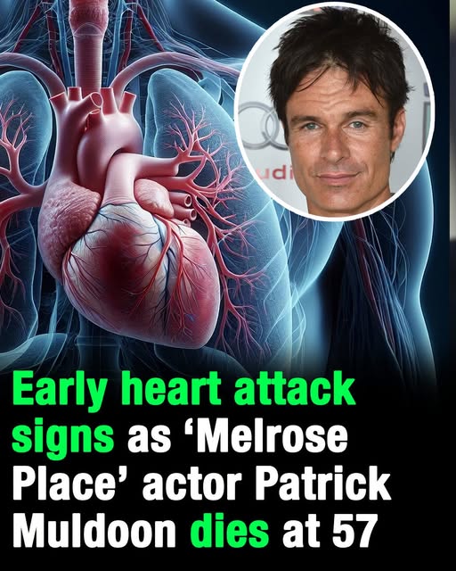 Early heart attack signs as ‘Melrose Place’ actor Patrick Muldoon dies at 57