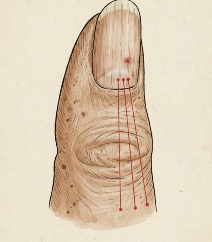 If You Have These Lines on Your Nails, You Should Pay Attention: