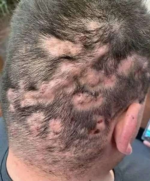 These are actually the first symptoms