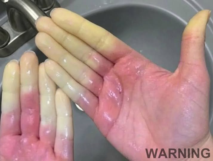 These are the consequences of sleeping with the…See more….