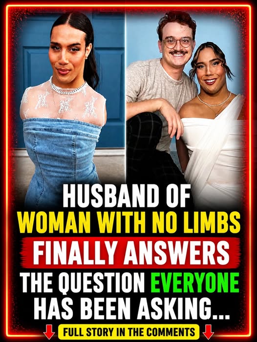 Husband Of Woman With No Limbs Finally Answers Question Everyone Always Asks