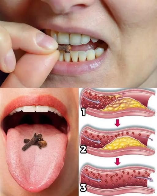 Cloves: 10 Health Benefits of Eating 2 Daily