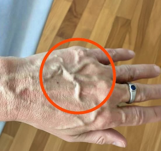 If you have visible veins it means you are…
