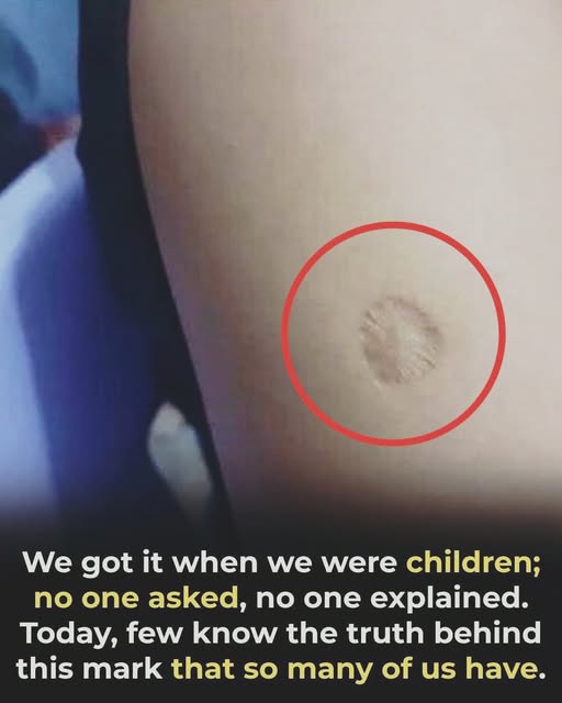 What the small round scar on your arm