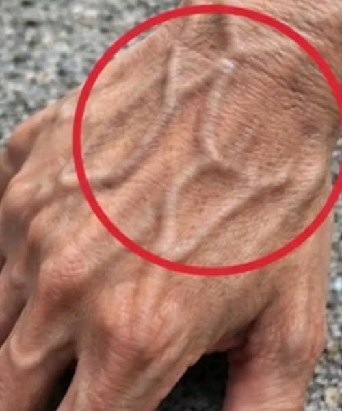If you have visible veins, it means you are….