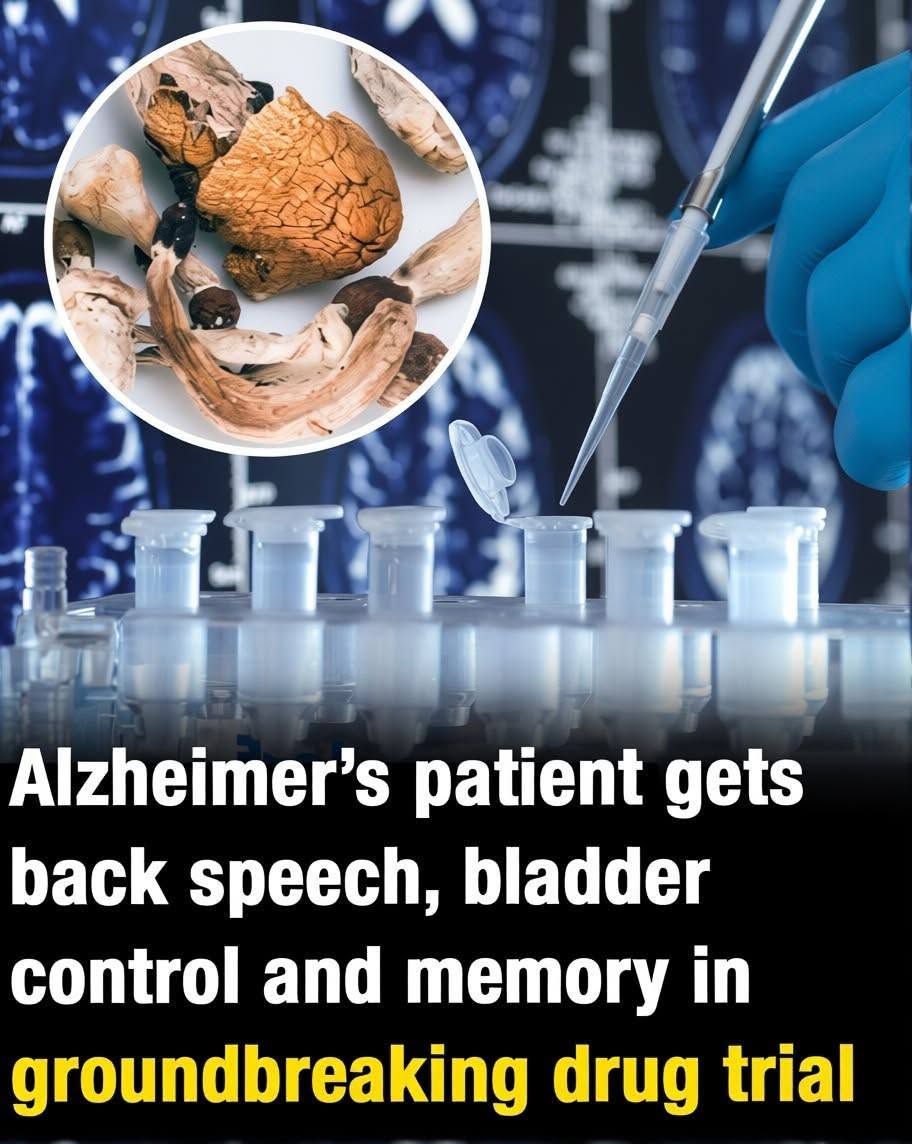 Doctors Were Stunned When an 80 Year Old Alzheimer’s Patient Suddenly Started Sharing Lost Memories—What Happened Next Left Researchers Searching for Answers