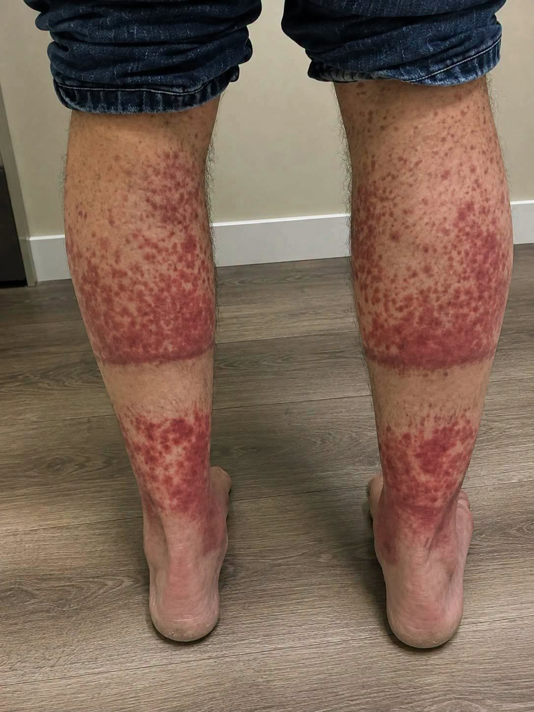 These are the consequences of sleeping with…
