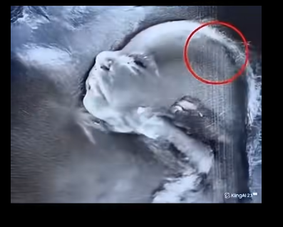 Doctors couldn’t believe what they saw during the ultrasound