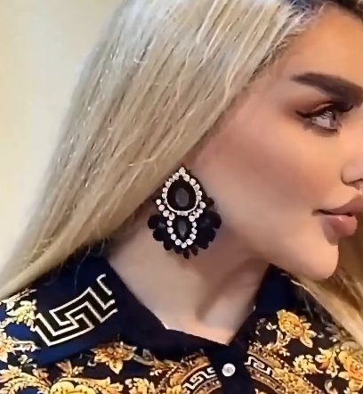 43 Surgeries to Look Like a Doll Spark Controversy